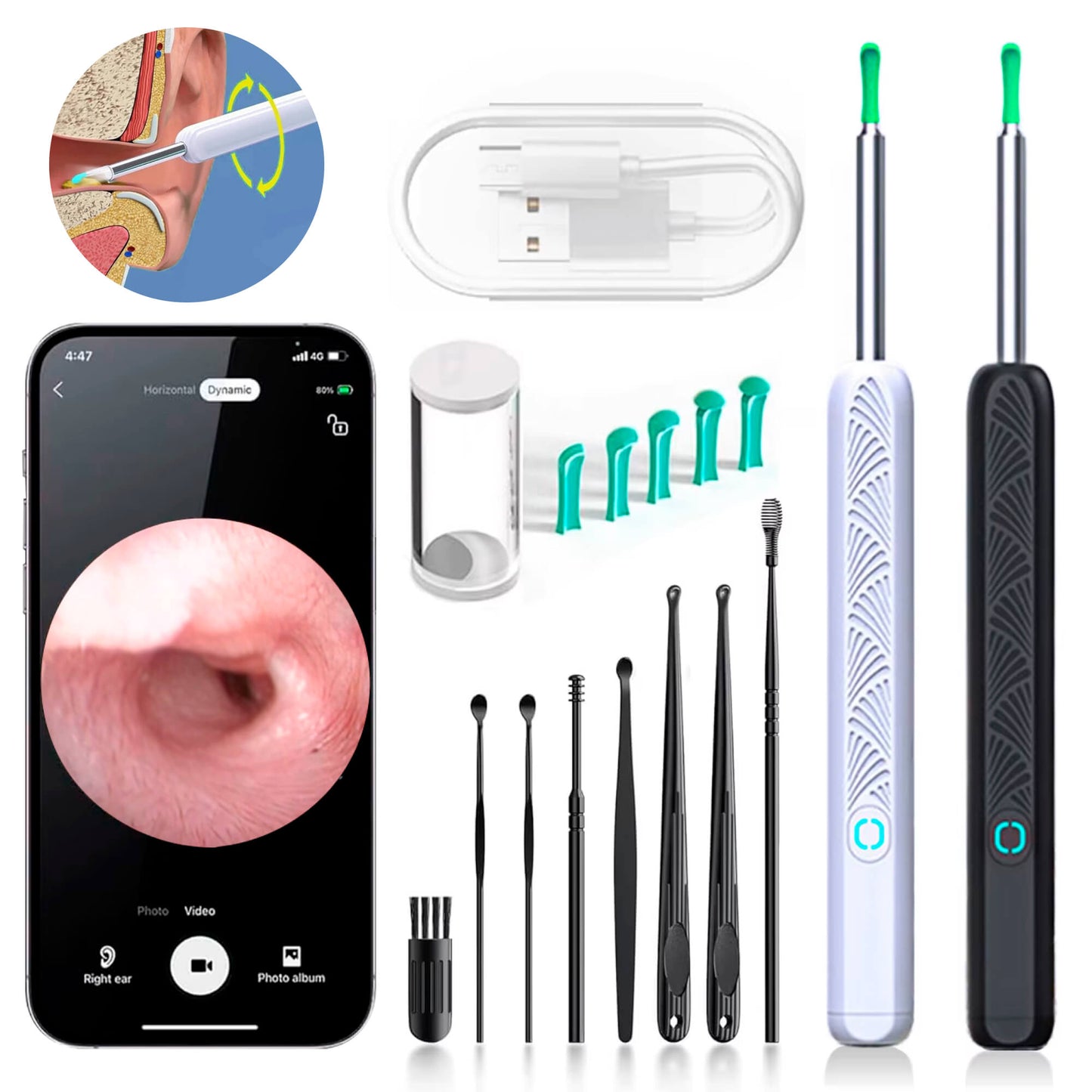 Skanto | EarScope Pro Earwax Removal Kit | High-Definition Camera & LED Light for Safe Home Use