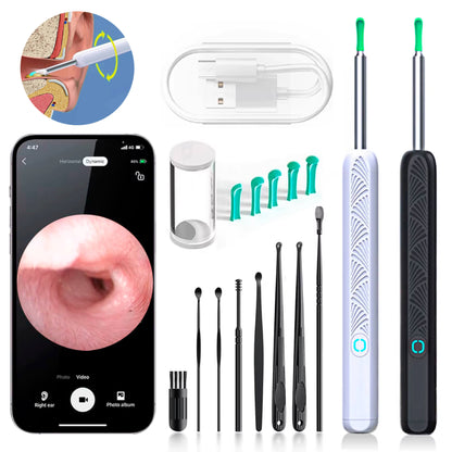 Skanto | EarScope Pro Earwax Removal Kit | High-Definition Camera & LED Light for Safe Home Use