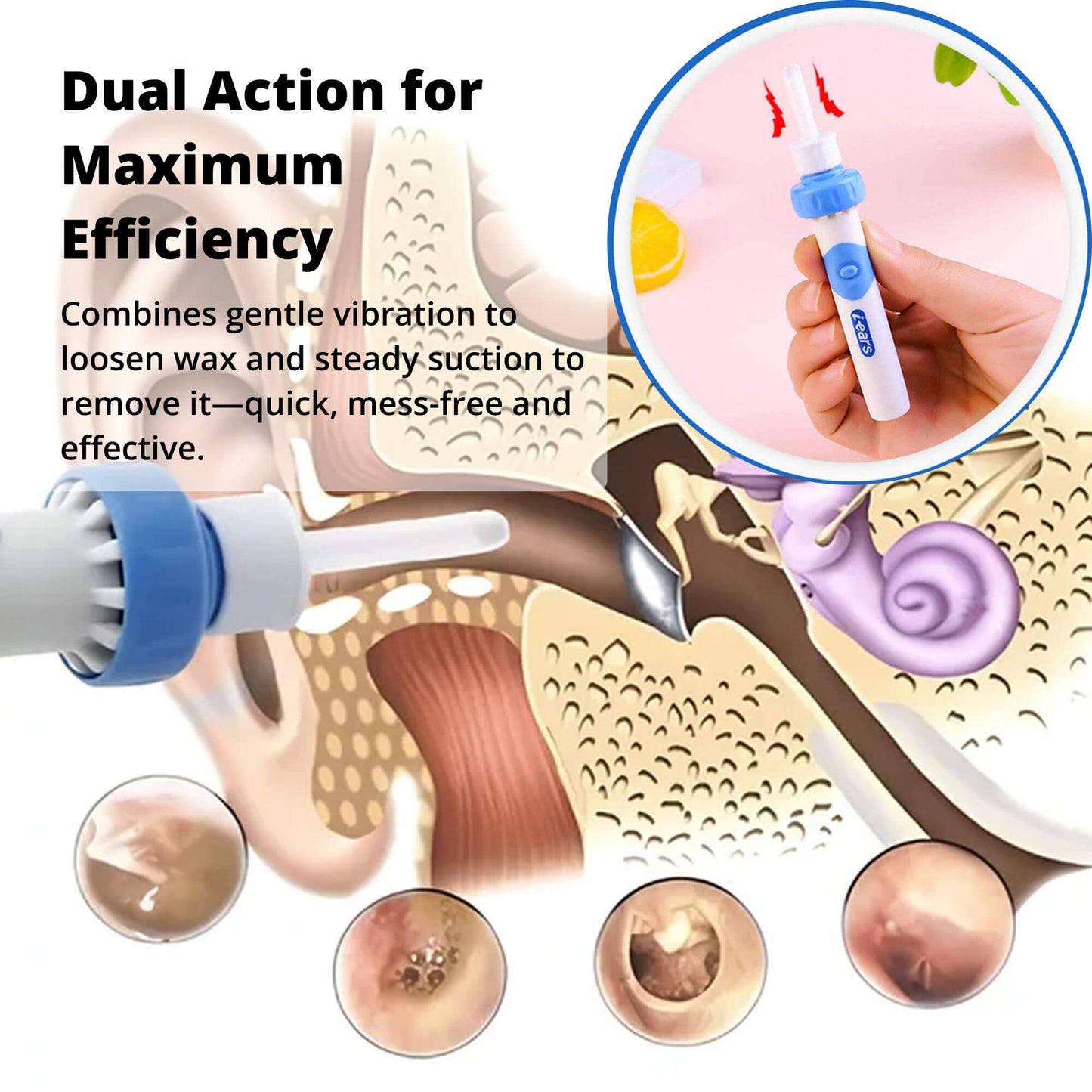 Skanto | Electric Earwax Suction Tool | Ergonomic, Silicone Tip & Compact Design for Safe Ear Hygiene at Home or Travel