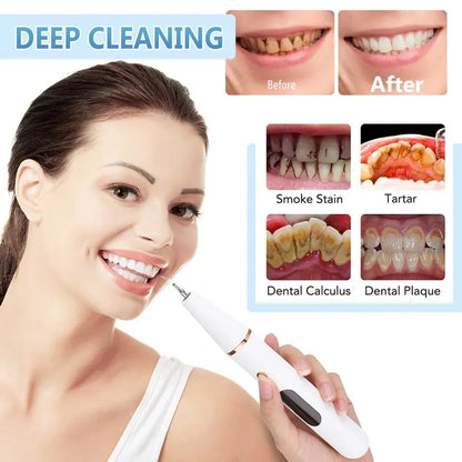Skanto | Ultrasonic Teeth Cleaner | 38 kHz Ultrasound, LED Light & USB Fast Charging for Home Dental Care