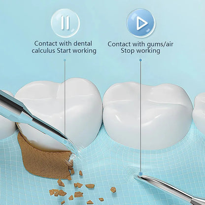 Skanto | Ultrasonic Teeth Cleaner | 38 kHz Ultrasound, LED Light & USB Fast Charging for Home Dental Care