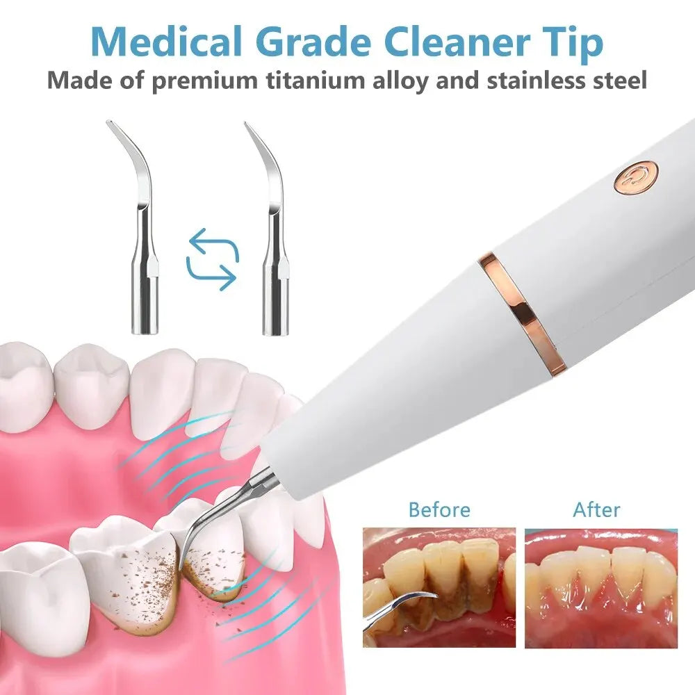Skanto | Ultrasonic Teeth Cleaner | 38 kHz Ultrasound, LED Light & USB Fast Charging for Home Dental Care