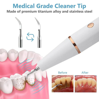 Skanto | Ultrasonic Teeth Cleaner | 38 kHz Ultrasound, LED Light & USB Fast Charging for Home Dental Care