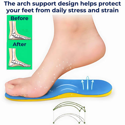 FootAlign Supination Insoles for Underpronation | Orthopedic Insoles - Foot Support - Daily Comfort Bowlift