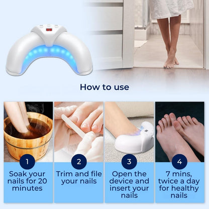 FungiFree | Laser Nail Fungus Device – Dual-Wavelength Penetration – Compact Home Use – Nail Fungus Restoration Skanto