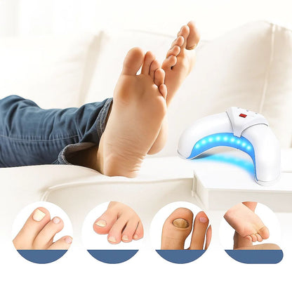 FungiFree | Laser Nail Fungus Device – Dual-Wavelength Penetration – Compact Home Use – Nail Fungus Restoration Skanto