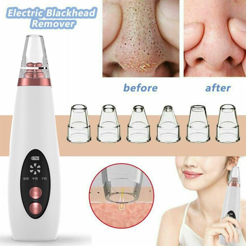 Brehn | Pure Skin rechargeable blackhead remover machine