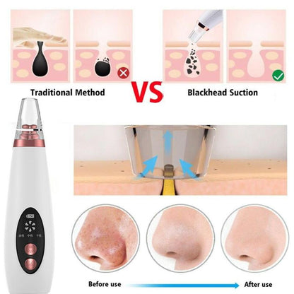 Brehn | Pure Skin rechargeable blackhead remover machine