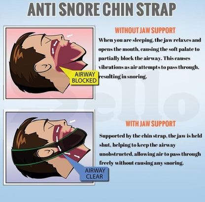 Karnz | Anti-Snoring Stop Snoring Chin Strap Belt