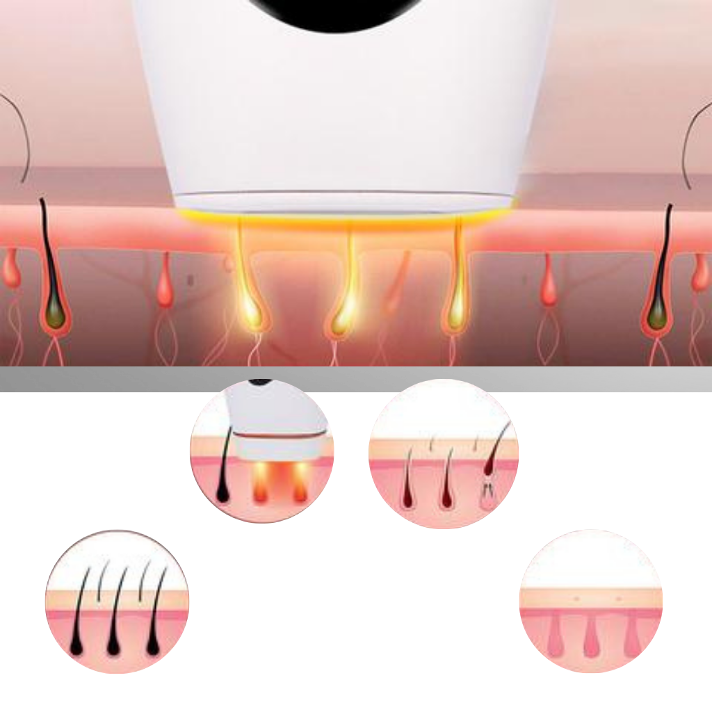 IPL Laser Hair Removal Device