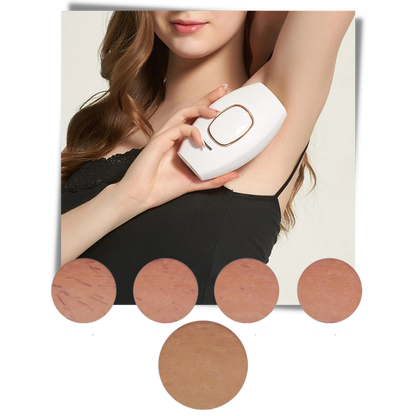 Mini IPL Laser Hair Remover