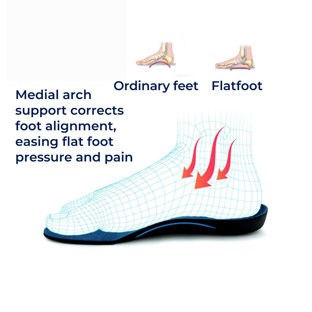 OrthoAlign Pronation Support | Inserts for Foot Alignment and Arch Relief - Orthopedic Shoe Inserts for Overpronation Correction Bowlift