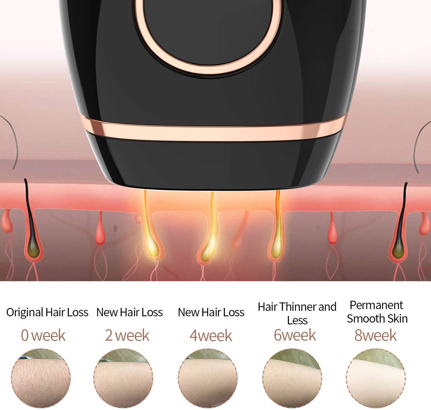 Skanto | Hair Removal System, Permanent Painless 999,999 Flashes