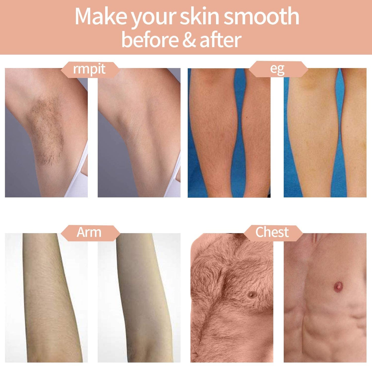 Skanto | Hair Removal System, Permanent Painless 999,999 Flashes