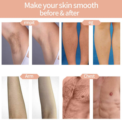 Skanto | Hair Removal System, Permanent Painless 999,999 Flashes