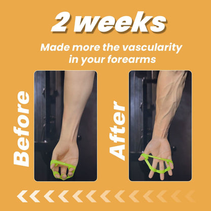 Skanto | 6-Piece Hand Trainer Set for Improved Grip Strength & Pain Relief