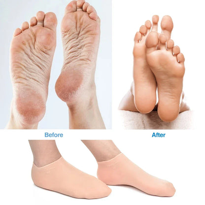BowLift | Silicone Wetsuit Beach Socks