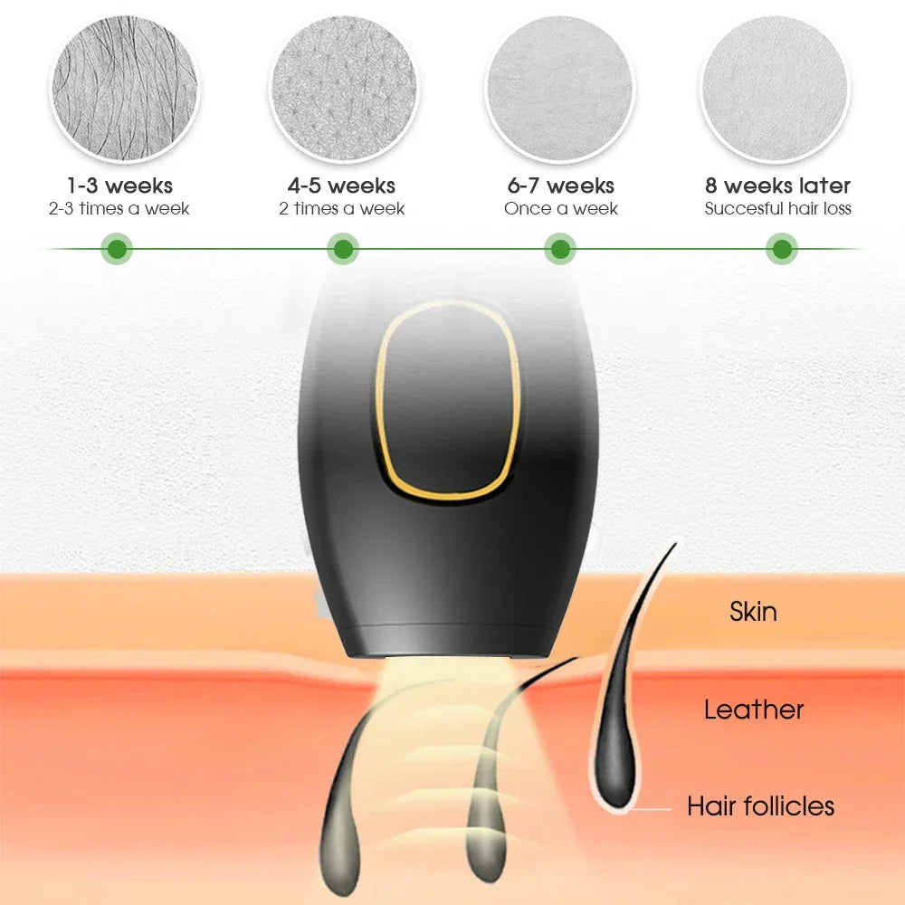 Sandsberg Bikini IPL 500.000 Flash Epilator Impulse Permanent Laser Epilator Painless For Women Hair Removal Home Use Devices