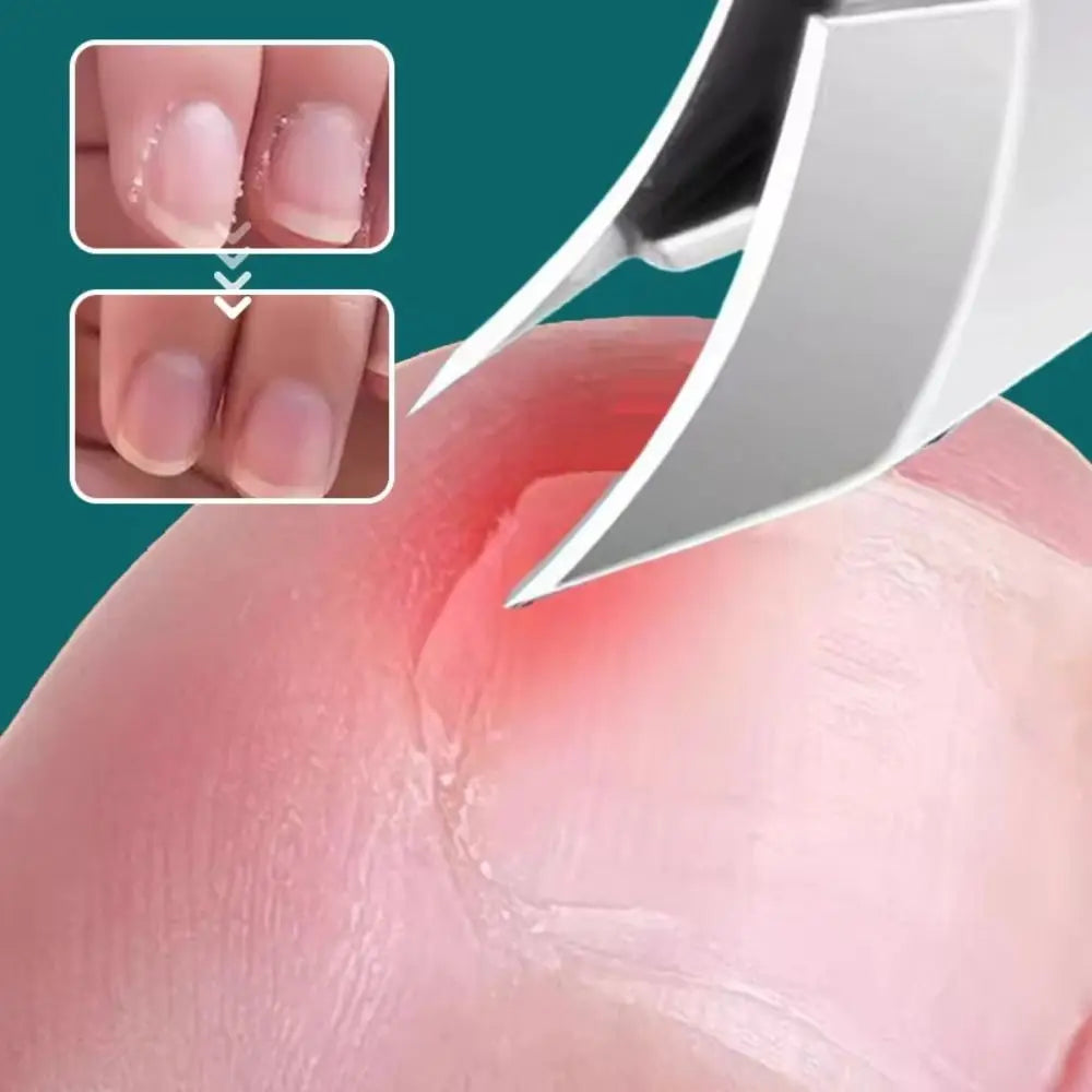 BowLift | Curved Edge Sharp Ingrown Nail Clipper