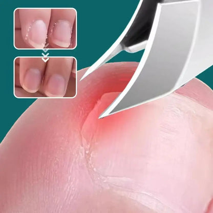 BowLift | Curved Edge Sharp Ingrown Nail Clipper