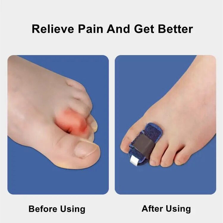 VIvolux | Gentle Touch Toe Corrector Stabilizer