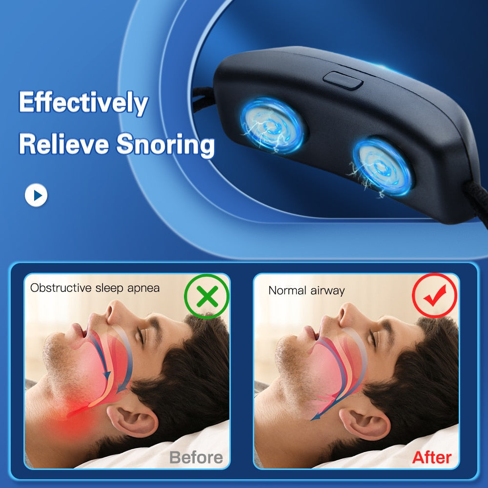 Intelligent Anti-Snoring Apnea Device