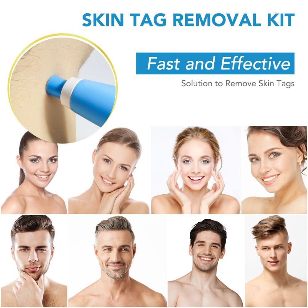 Preparations for the removal of skin spots, warts and skin tags
