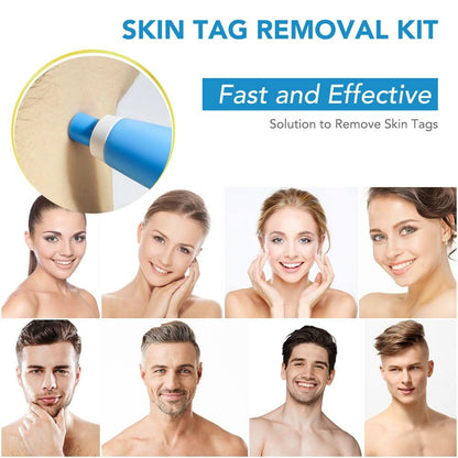 Preparations for the removal of skin spots, warts and skin tags