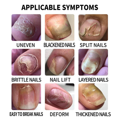 BowLift | Nail Fungus Defender Serum