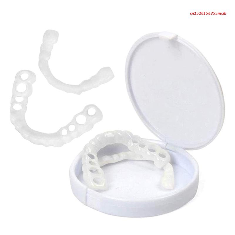 BowLift | SmileSnap - Always the perfect smile with these veneers