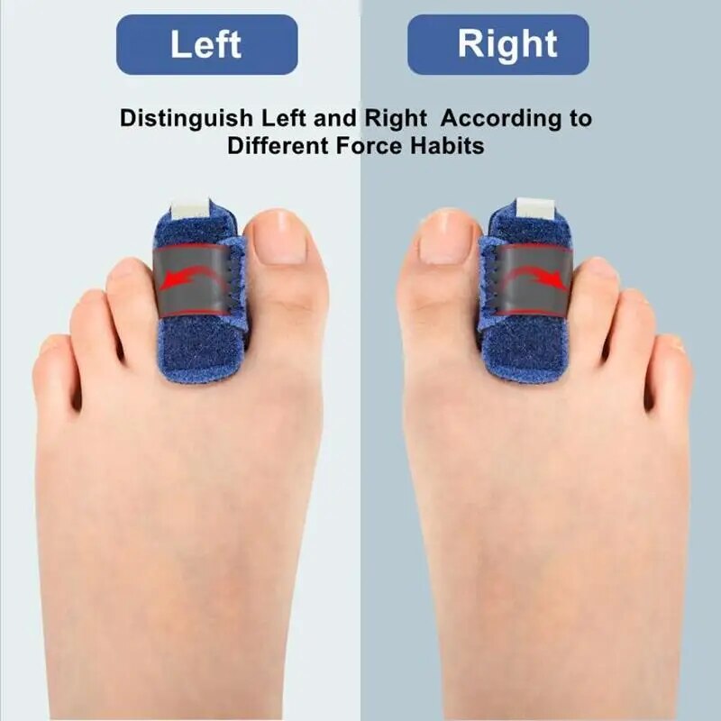 VIvolux | Gentle Touch Toe Corrector Stabilizer