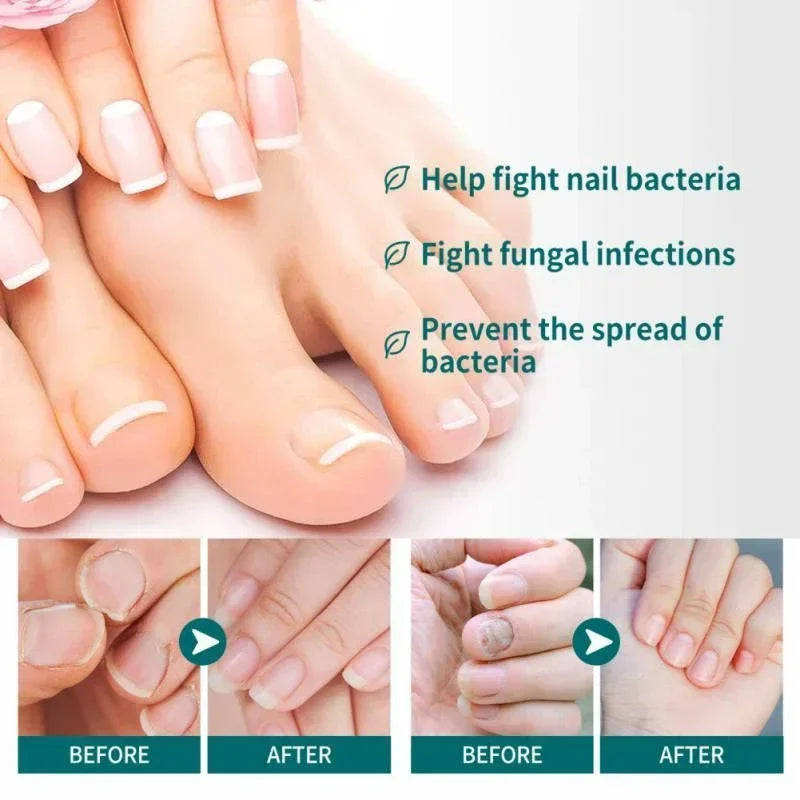 BowLift | Nail Fungus Defender Serum