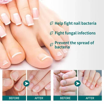 BowLift | Nail Fungus Defender Serum