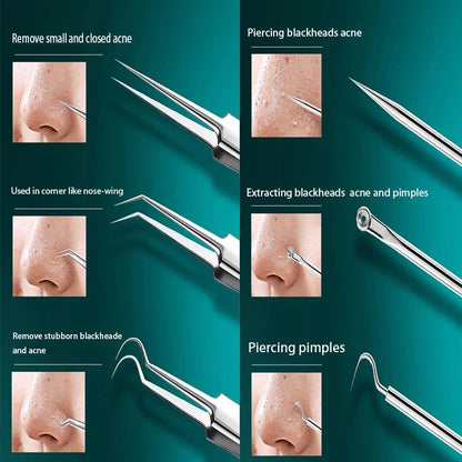 BowLift | Clear Skin Blackhead Remover Care Kit