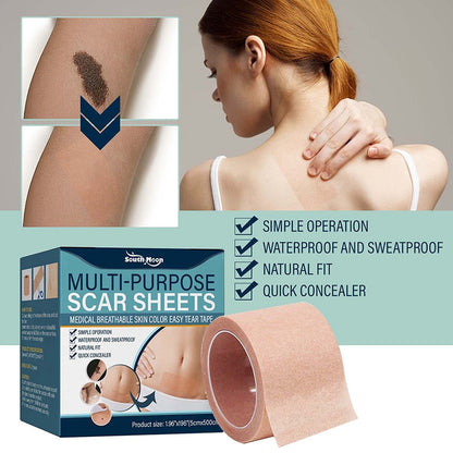 Soft Silicone Gel Tape for Scar Removal | Skanto