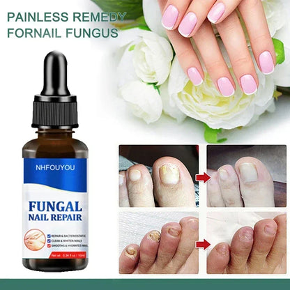 BowLift | Nail Fungus Defender Serum
