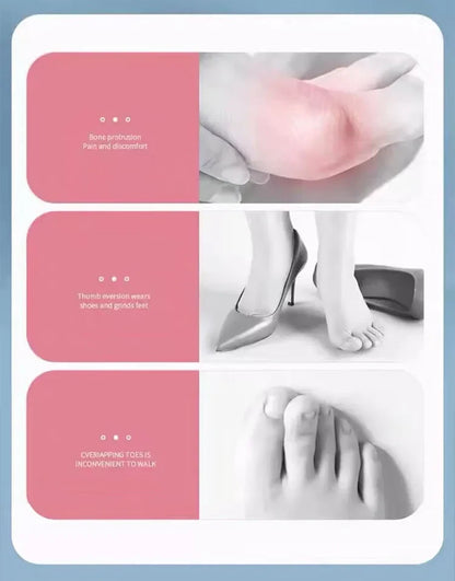 BowLift | Silicone Hallux Valgus Bunion Corrector