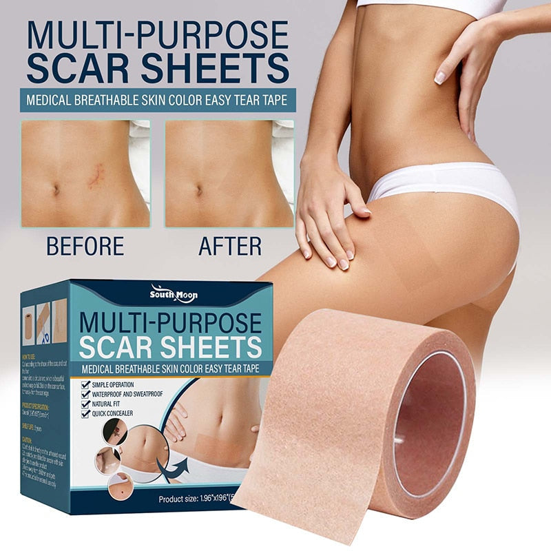 Soft Silicone Gel Tape for Scar Removal | Karnz
