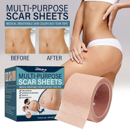 Soft Silicone Gel Tape for Scar Removal | Karnz