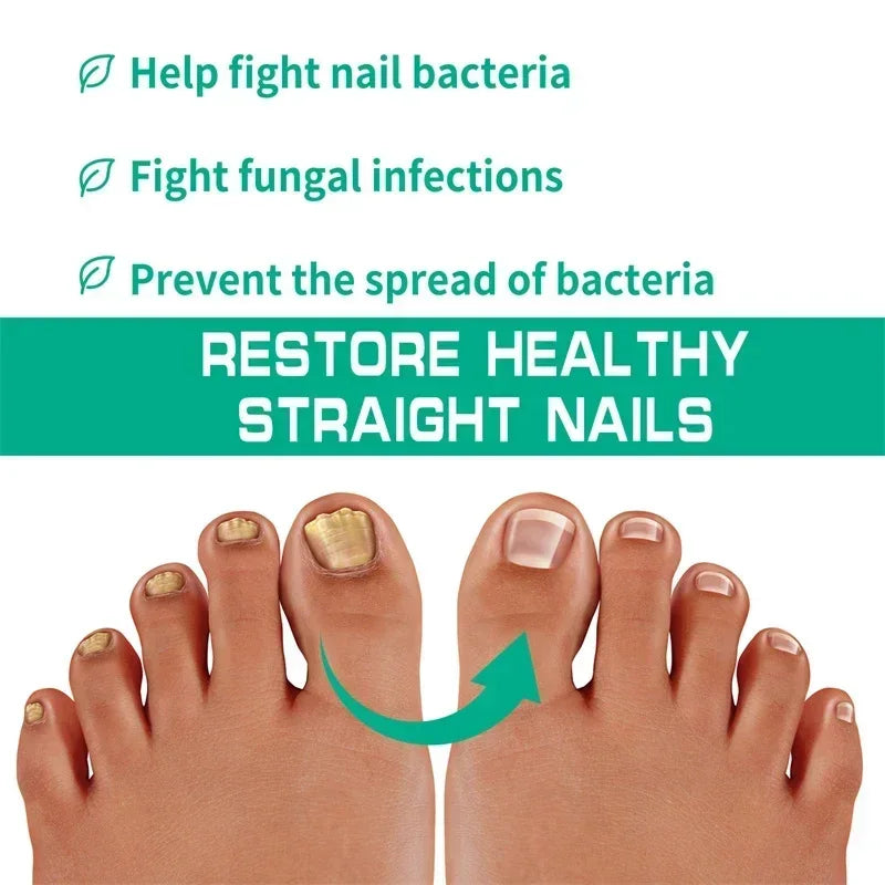 BowLift | Nail Fungus Defender Serum
