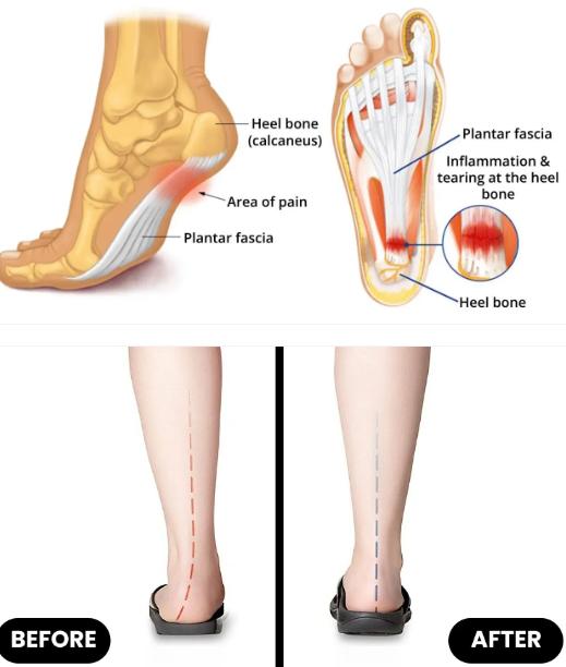 Orthotic Insole | Soft, Supportive, Breathable | Norvo