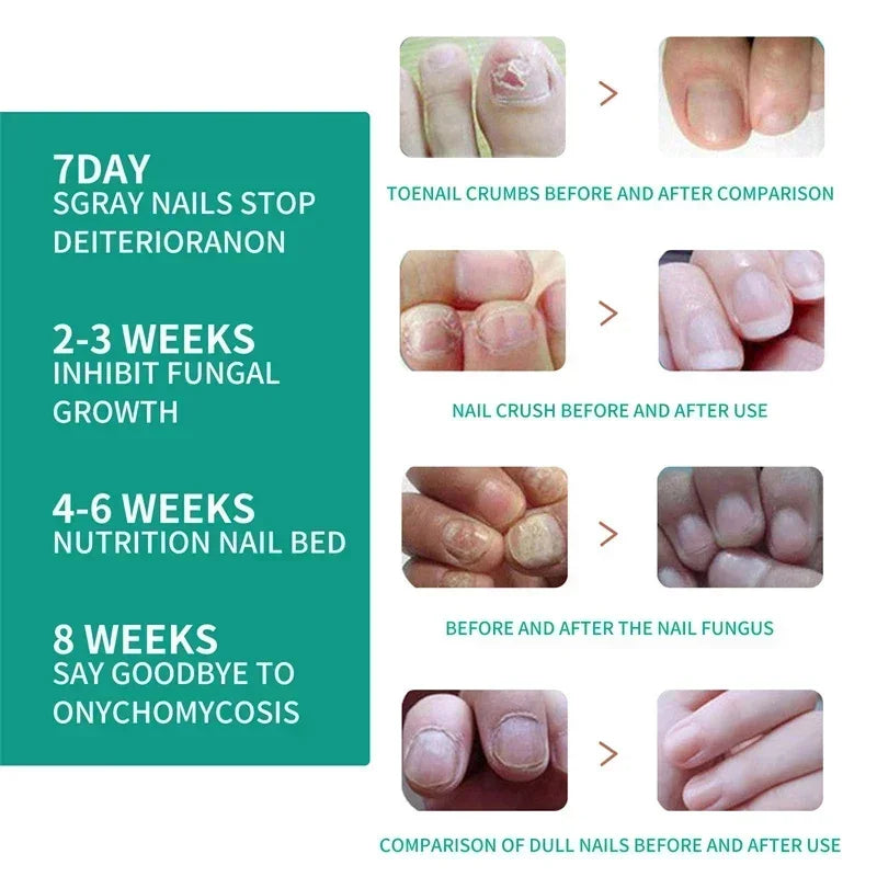 BowLift | Nail Fungus Defender Serum