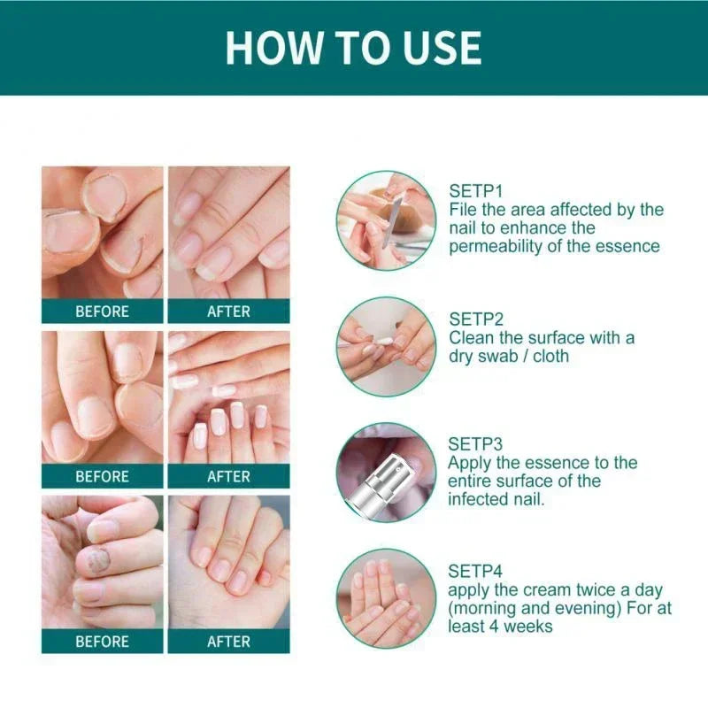BowLift | Nail Fungus Defender Serum