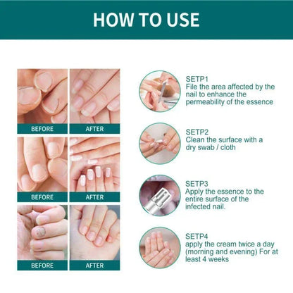 BowLift | Nail Fungus Defender Serum