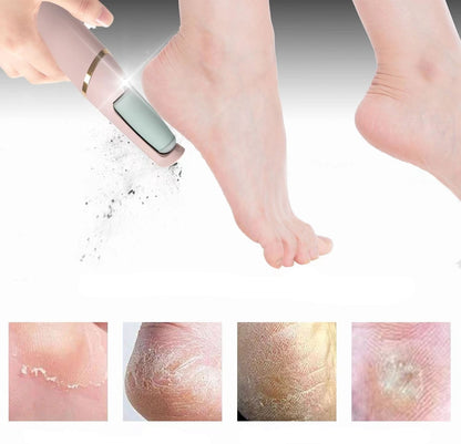 Skanto | Foot Callus Remover – For Soft and Well-Groomed Feet