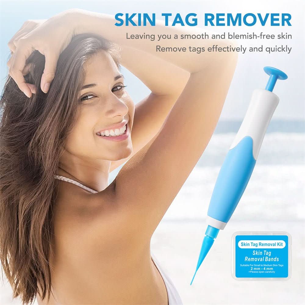 Preparations for the removal of skin spots, warts and skin tags