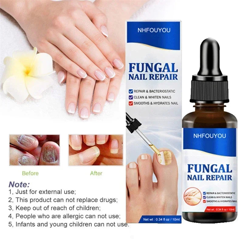 BowLift | Nail Fungus Defender Serum