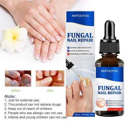 BowLift | Nail Fungus Defender Serum