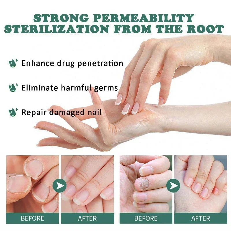 BowLift | Nail Fungus Defender Serum