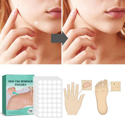 Skanto | SkinClear - Plaster for the removal of spots and warts